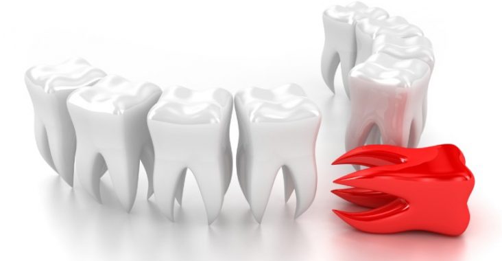 Efektywne i profesjonalne leczenie kanałowe zębów.